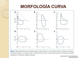 MORFOLOGÍA CURVA
 