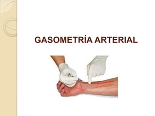 GASOMETRÍA ARTERIAL
 