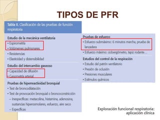 TIPOS DE PFR
 