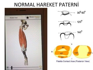 NORMAL HAREKET PATERNİ 
 