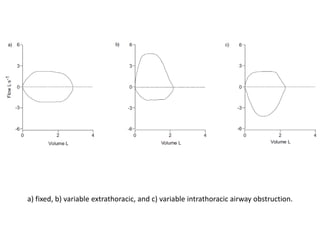 a) fixed, b) variable extrathoracic, and c) variable intrathoracic airway obstruction. 
 