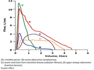(A) a healthy person (B) severe obstruction (emphysema), 
(C) severe restriction from interstitial disease (radiation fibrosis), (D) upper airways obstruction 
(tracheal stenosis), 
E) poor effort. 
 