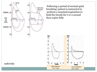 Following a period of normal quiet
breathing' patient is instructed to
perform a maximal inspiration to
hold the breath for I or 2 secand
then expire fully
sadowsky
 
