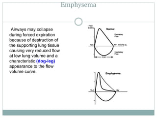 Emphysema
Airways may collapse
during forced expiration
because of destruction of
the supporting lung tissue
causing very reduced flow
at low lung volume and a
characteristic (dog-leg)
appearance to the flow
volume curve.
 