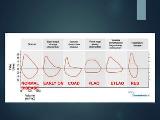 NORMAL EARLY ON COAD FLAO ETLAO RES
DISEASE
 