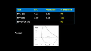 Test Ref. Measured % predicted
FVC (L) 4.07 3.80 93
FEV1 (L) 3.30 3.61 109
FEV1/FVC (%) 95
Normal
 