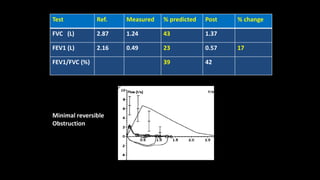 Test Ref. Measured % predicted Post % change
FVC (L) 2.87 1.24 43 1.37
FEV1 (L) 2.16 0.49 23 0.57 17
FEV1/FVC (%) 39 42
Minimal reversible
Obstruction
 