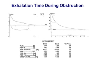 Exhalation Time During Obstruction
 