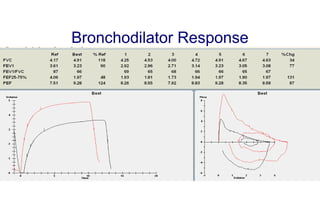 Bronchodilator Response
 