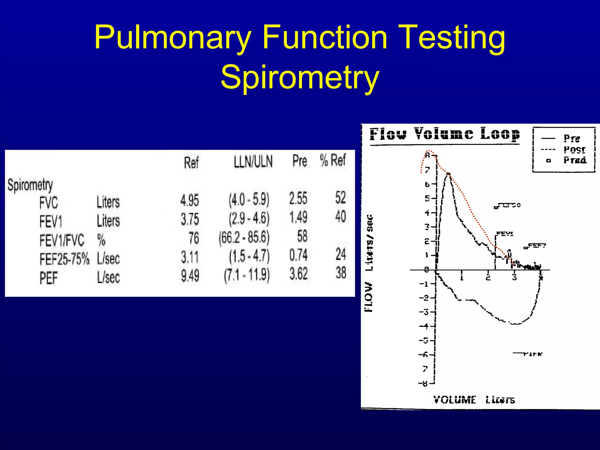 Pulmonary Function Testing
Spirometry
 