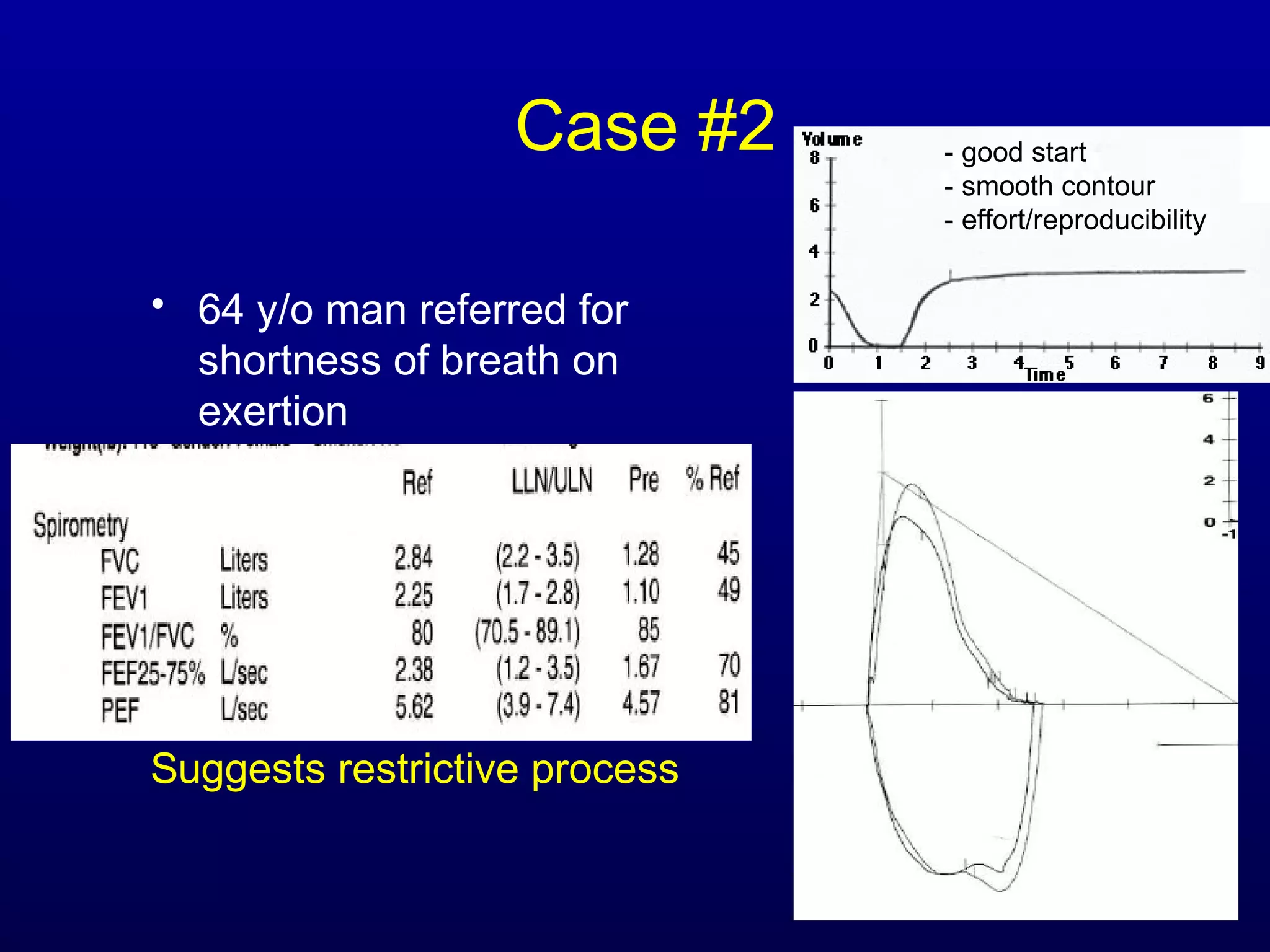 Case #2
• 64 y/o man referred for
shortness of breath on
exertion
Suggests restrictive process
- good start
- smooth contour
- effort/reproducibility
 