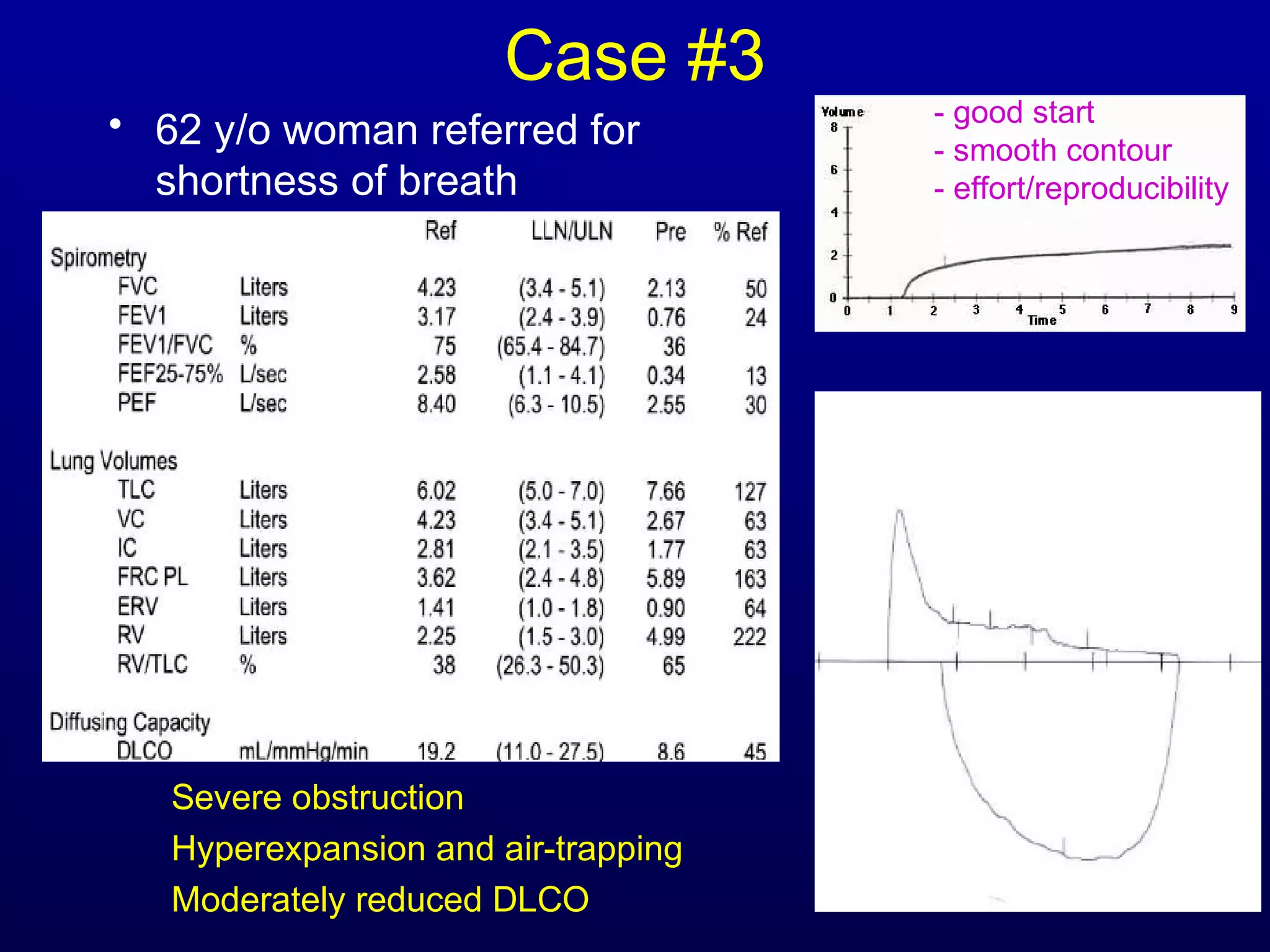 Case #3
• 62 y/o woman referred for
shortness of breath
Severe obstruction
Hyperexpansion and air-trapping
Moderately reduced DLCO
- good start
- smooth contour
- effort/reproducibility
 