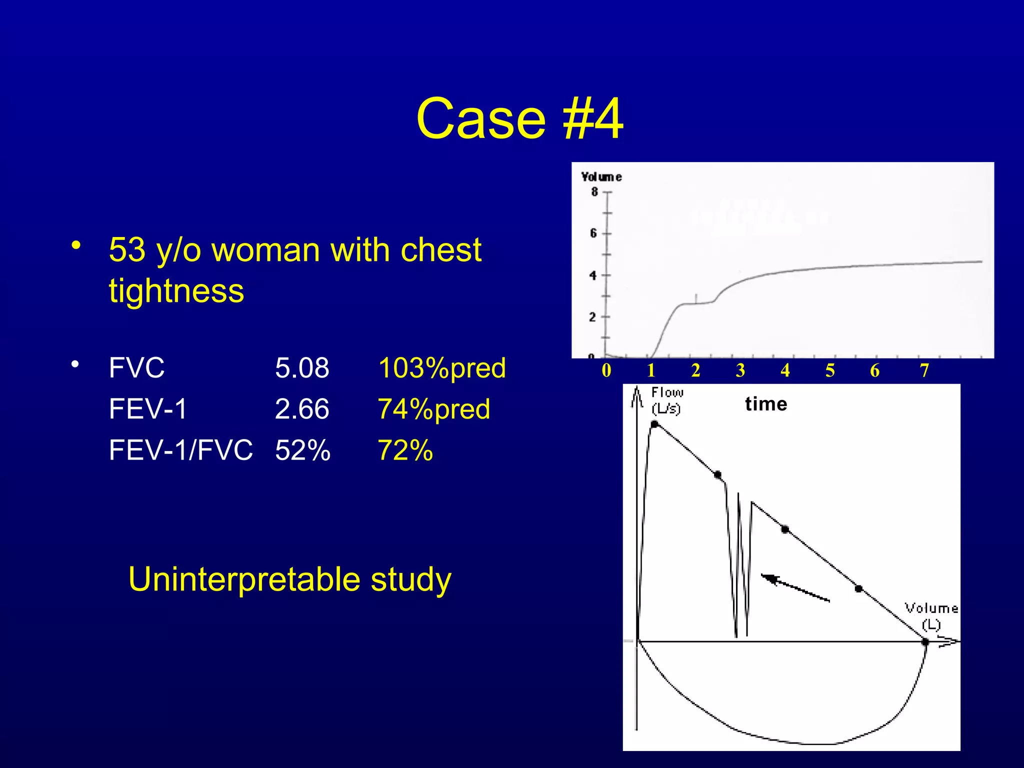 Case #4
• 53 y/o woman with chest
tightness
• FVC 5.08 103%pred
FEV-1 2.66 74%pred
FEV-1/FVC 52% 72%
Uninterpretable study
0 1 2 3 4 5 6 7
time
 