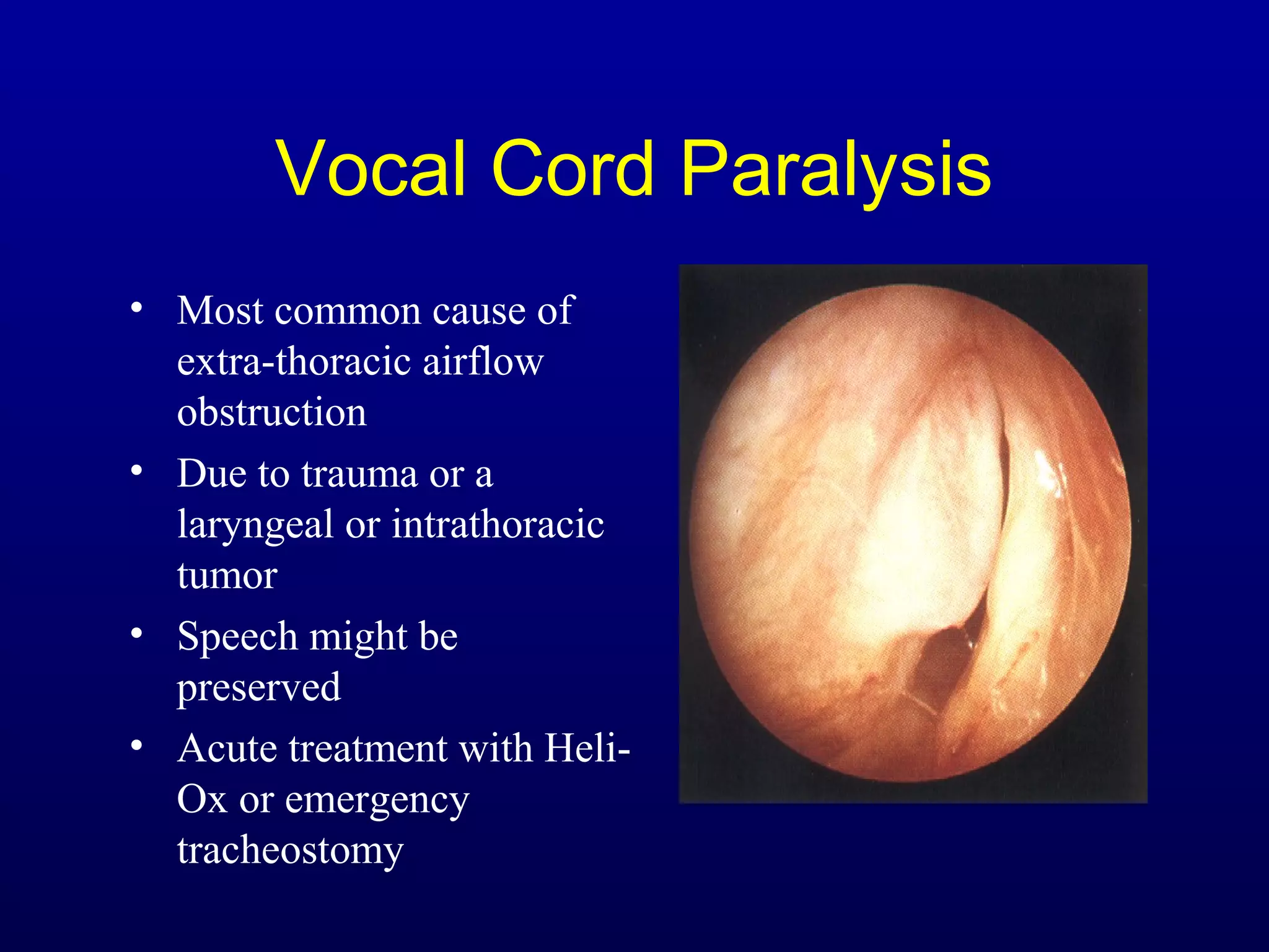 Vocal Cord Paralysis
• Most common cause of
extra-thoracic airflow
obstruction
• Due to trauma or a
laryngeal or intrathoracic
tumor
• Speech might be
preserved
• Acute treatment with Heli-
Ox or emergency
tracheostomy
 