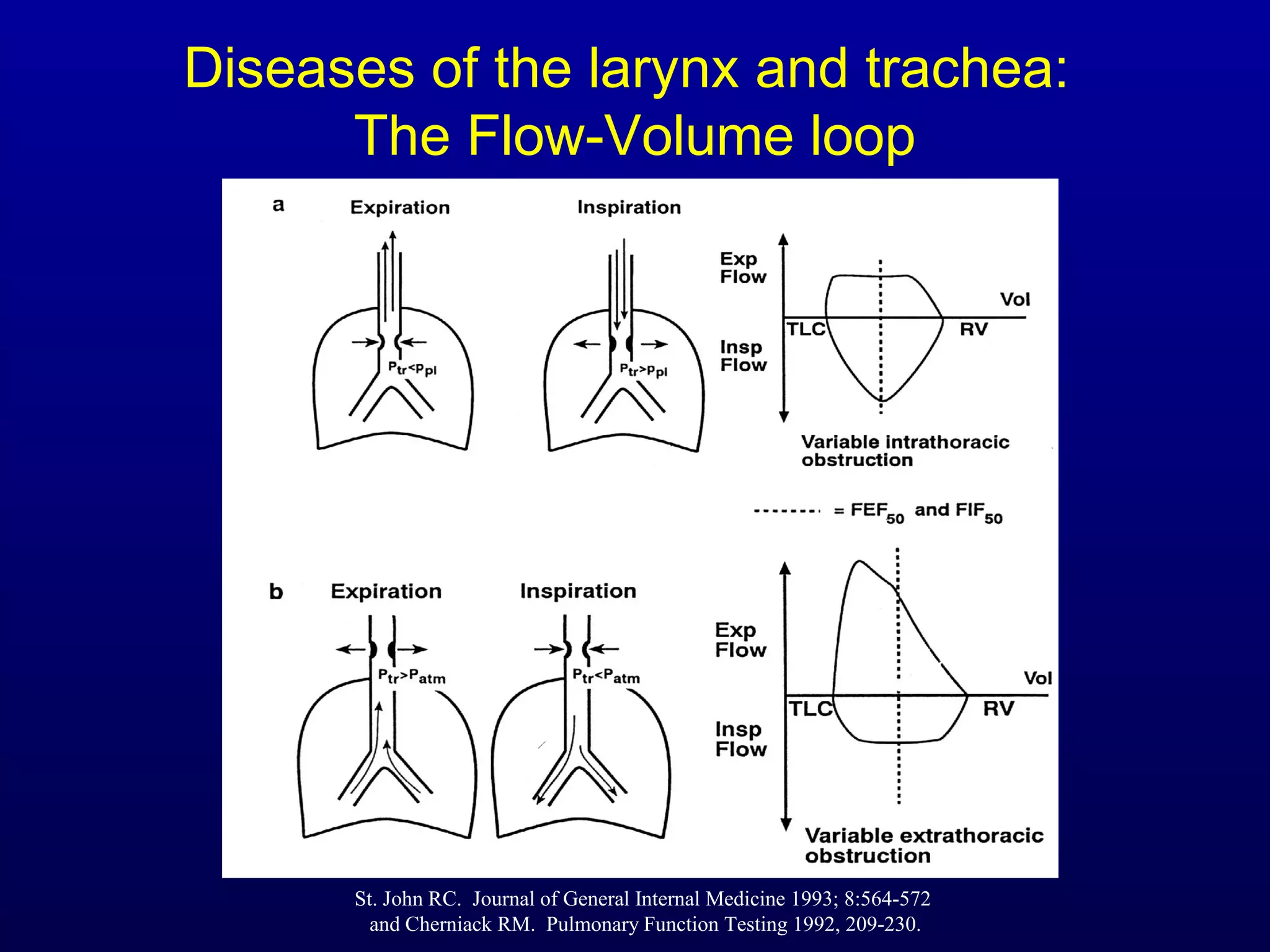 Diseases of the larynx and trachea:
The Flow-Volume loop
St. John RC. Journal of General Internal Medicine 1993; 8:564-572
and Cherniack RM. Pulmonary Function Testing 1992, 209-230.
 