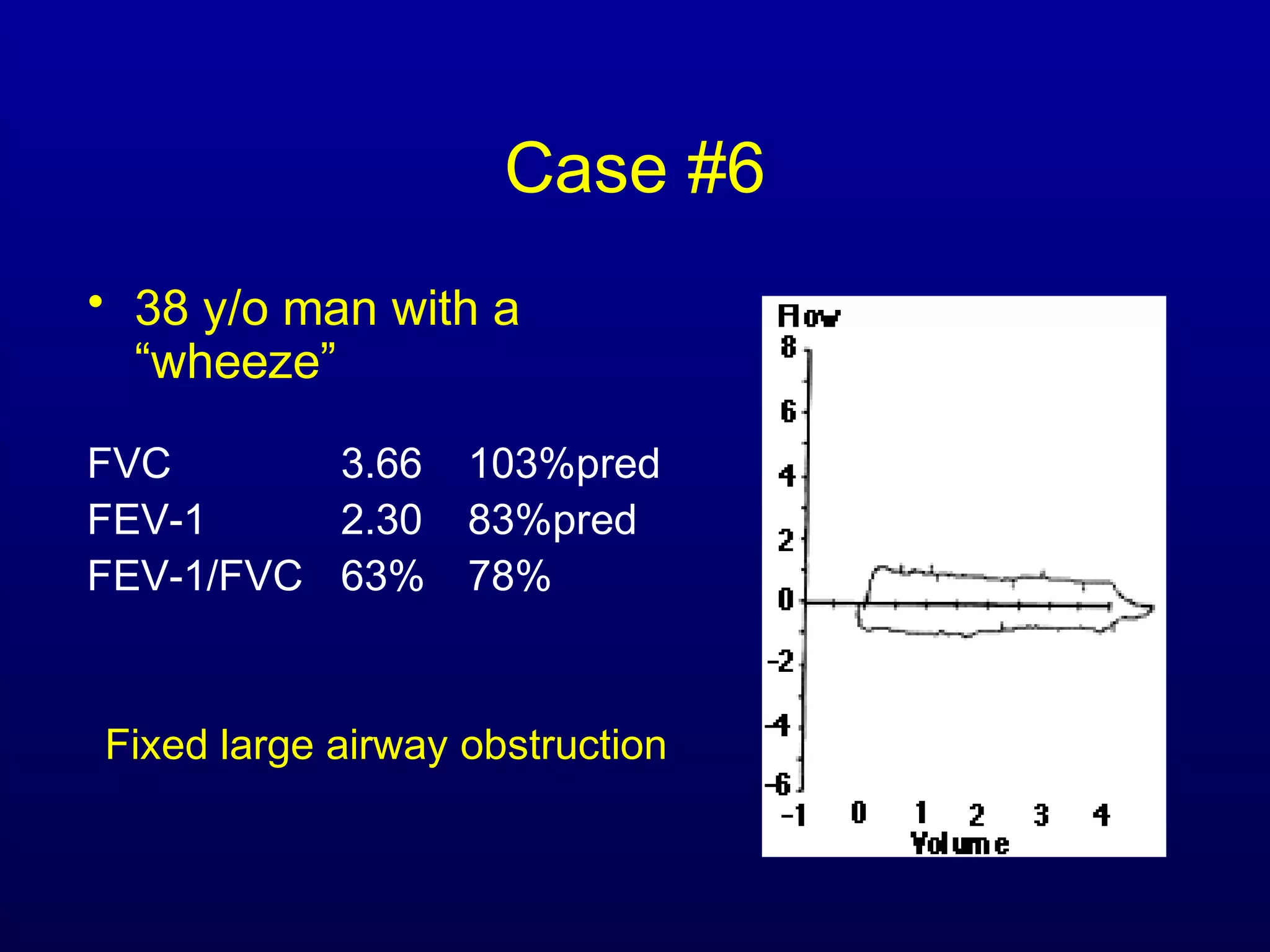Case #6
• 38 y/o man with a
“wheeze”
FVC 3.66 103%pred
FEV-1 2.30 83%pred
FEV-1/FVC 63% 78%
Fixed large airway obstruction
 