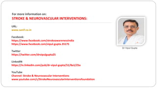 For more information on:
STROKE & NEUROVASCULAR INTERVENTIONS:
URL:
www.sanif.co.in
Facebook:
https://www.facebook.com/strokeawarenessindia
https://www.facebook.com/vipul.gupta.35175
Twitter
https://twitter.com/drvipulgupta25
LinkedIN
https://in.linkedin.com/pub/dr-vipul-gupta/51/8a1/25a
YouTube
Channel: Stroke & Neurovascular Interventions
www.youtube.com/c/StrokeNeurovascularInterventionsfoundation
Dr Vipul Gupta
 