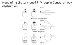 Need of inspiratory loop? F- V loop in Central airway
obstruction
 