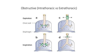 Obstructive (Intrathoracic vs Extrathoracic)
 