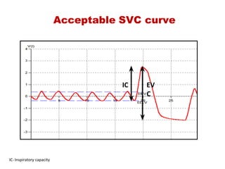 Acceptable SVC curve
IC EV
C
IC‐ Inspiratory capacity
 