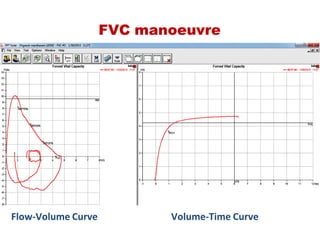 FVC manoeuvre
Volume‐Time CurveFlow‐Volume Curve
 