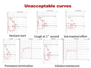 Unacceptable curves
Hesitant start Sub maximal effortCough at 1st
  second
Valsalva manoeuvrePremature termination
 
