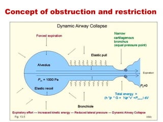 Concept of obstruction and restriction
Respiratory disease Obstruction Restriction
Basic pathology Airway  obstruction Parenchymal  or extra
parenchymal damage
restricting the chest wall
expansion
Functional defect Increased airway resistance Reduced compliance
Forced Vital capacity Normal
May be declined in severe
obstruction
Reduced
May be normal in early
stages of restriction
Slow vital capacity Normal even in severe stages
(Dynamic airway narrowing)
Reduced
e.g. Chronic obstructive airway
disease
Bronchial Asthma
Interstitial Lung Disease
Morbid Obesity
Kyphoscoliosis
 