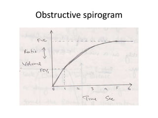 Obstructive spirogram
 