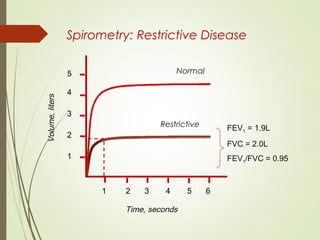 Spirometry: Restrictive Disease
Volume,liters
Time, seconds
FEV1 = 1.9L
FVC = 2.0L
FEV1/FVC = 0.95
1 2 3 4 5 6
5
4
3
2
1
Normal
Restrictive
 