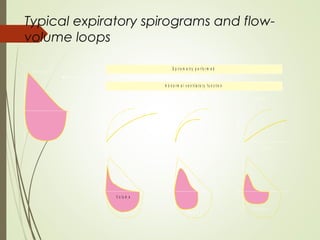 Typical expiratory spirograms and flow-
volume loops
Volume
T im e
O b s tr u c t io n
Volume
T im e
R e s tr ic tio n
Volume
T im e
M ix e dFlow
V o lu m e
Flow
V o lu m e
Flow
V o lu m e
N o r m a l ( ? )
A b n o r m a l v e n t ila t o r y f u n c t io n
S p ir o m e tr y p e r f o r m e d
 