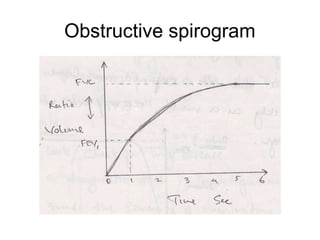 Obstructive spirogram
 