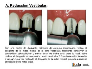 Con una piedra de diamante, cilíndrica de extremo redondeado realice el
desgaste de la mitad mesial de la cara vestibular. Recuerde conservar la
convexidad cérvicoincisal y mesio distal de dicha cara, para lo cual, debe
realizar el desgaste en dos planos: tercio cervical – 2 /3 restantes (tercio medio
e incisal). Una vez realizado el desgaste de la mitad mesial, proceda a realizar
el desgate de la mitad distal.
A. Reducción Vestibular:
 