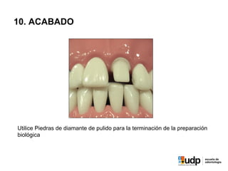 10. ACABADO
Utilice Piedras de diamante de pulido para la terminación de la preparación
biológica
 