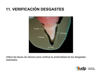11. VERIFICACIÓN DESGASTES
Utilice las llaves de silicona para verificar la profundidad de los desgastes
realizados.
 