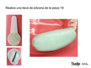 Realice una llave de silicona de la pieza 19
 