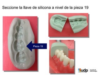 Pieza 19
Seccione la llave de silicona a nivel de la pieza 19
 