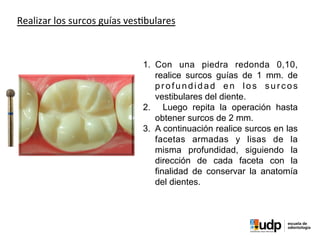 PRECLÍNICO	
  Y	
  BIOMATERIALES	
  IV	
  
Realizar	
  los	
  surcos	
  guías	
  ves?bulares
1.  Con una piedra redonda 0,10,
realice surcos guías de 1 mm. de
profundidad en los surcos
vestibulares del diente.
2.  Luego repita la operación hasta
obtener surcos de 2 mm.
3.  A continuación realice surcos en las
facetas armadas y lisas de la
misma profundidad, siguiendo la
dirección de cada faceta con la
finalidad de conservar la anatomía
del dientes.
 