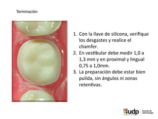PRECLÍNICO	
  Y	
  BIOMATERIALES	
  IV	
  
1.  Con	
  la	
  llave	
  de	
  silicona,	
  veriﬁque	
  
los	
  desgastes	
  y	
  realice	
  el	
  
chamfer.	
  
2.  En	
  ves?bular	
  debe	
  medir	
  1,0	
  a	
  
1,3	
  mm	
  y	
  en	
  proximal	
  y	
  lingual	
  
0,75	
  a	
  1,0mm.	
  
3.  La	
  preparación	
  debe	
  estar	
  bien	
  
pulida,	
  sin	
  ángulos	
  ni	
  zonas	
  
reten?vas.	
  
Terminación
 