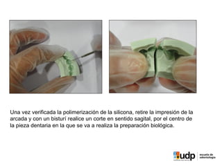 Una vez verificada la polimerización de la silicona, retire la impresión de la
arcada y con un bisturí realice un corte en sentido sagital, por el centro de
la pieza dentaria en la que se va a realiza la preparación biológica.
 