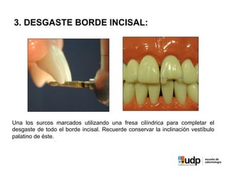 3. DESGASTE BORDE INCISAL:
Una los surcos marcados utilizando una fresa cilíndrica para completar el
desgaste de todo el borde incisal. Recuerde conservar la inclinación vestíbulo
palatino de éste.
 
