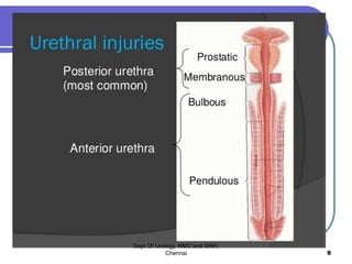 Dept Of Urology, KMC and GRH,
Chennai 9
 