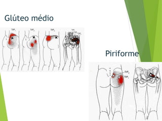 Glúteo médio
Piriforme
 