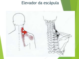 Elevador da escápula
 