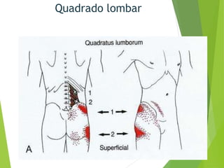 Quadrado lombar
 