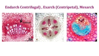 PG Anatomy Node nodal anatomy Cambium Differentiation | PDF