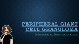 PERIPHERAL GIANT
CELL GRANULOMA
An benign tumour of connective tissue origin
 