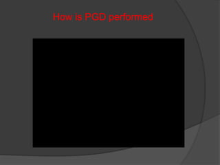 How is PGD performed
 