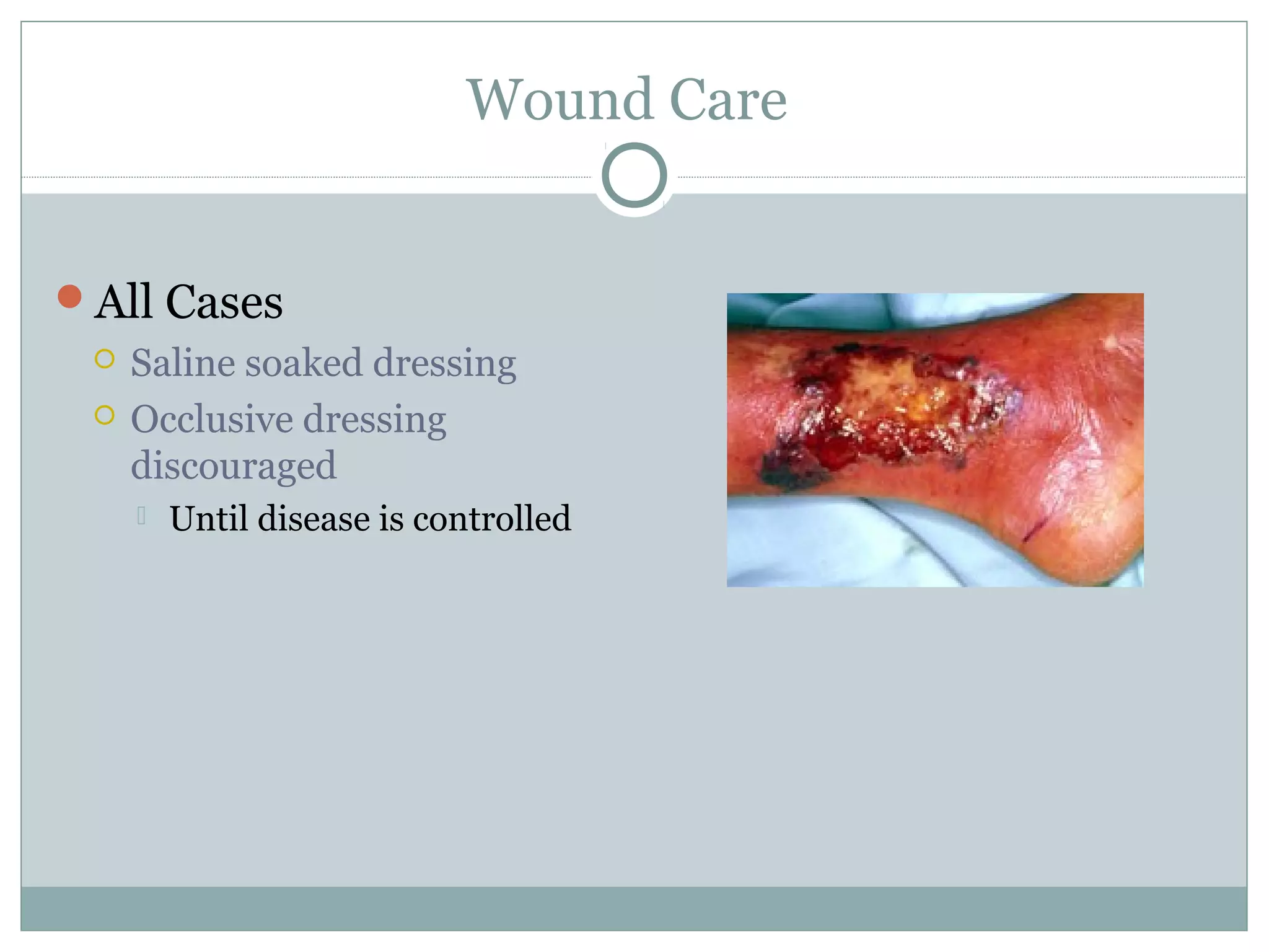 Wound Care
All Cases
 Saline soaked dressing
 Occlusive dressing
discouraged
 Until disease is controlled
 