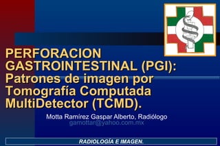 Motta Ramírez Gaspar Alberto, Radiólogo [email_address] RADIOLOGÍA E IMAGEN. PERFORACION GASTROINTESTINAL (PGI): Patrones de imagen por Tomografía Computada MultiDetector (TCMD). 