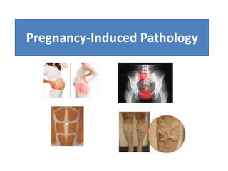 Pregnancy-Induced Pathology
 